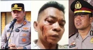 Hanya di Polres Sumenep, Wartawan Korban Pengeroyokan Malah Dijadikan Tersangka - Teropongrakyat.co