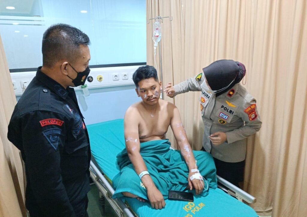 Portal Berita Indonesia dan Dunia Terkini Hari Ini, Update Harian Terbaru, Terlengkap, Tajam, Aktual dan Berimbang. Bubarkan Tawuran Bassura anggota Brimob disiram air keras, Polres Metro Jaktim buru pelaku!!! - Teropong Rakyat