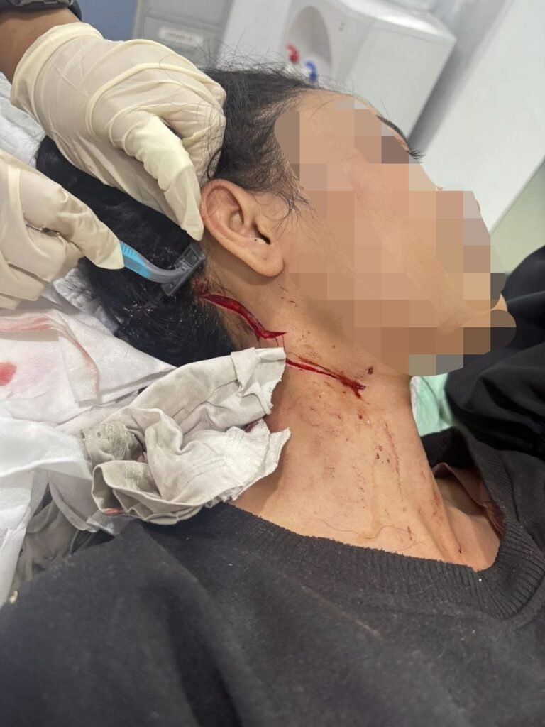 Gagal Rampas Tas, Pria di Tanah Abang Bacok Korban hingga Luka 20 Jahitan - Teropong Rakyat