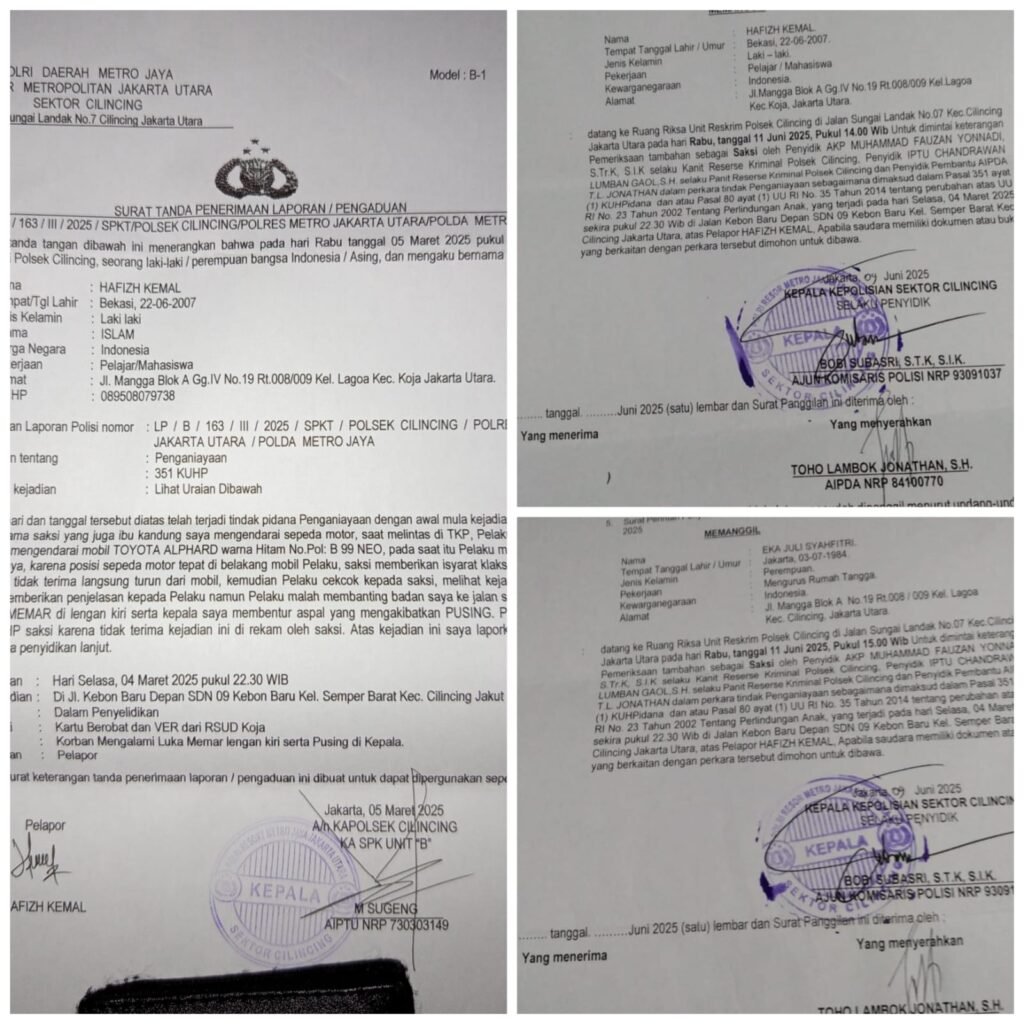 Portal Berita Indonesia dan Dunia Terkini Hari Ini, Update Harian Terbaru, Terlengkap, Tajam, Aktual dan Berimbang. Kinerja Polsek Cilincing Lamban, Pelaku Penganiayaan Masih Bebas - Teropong Rakyat