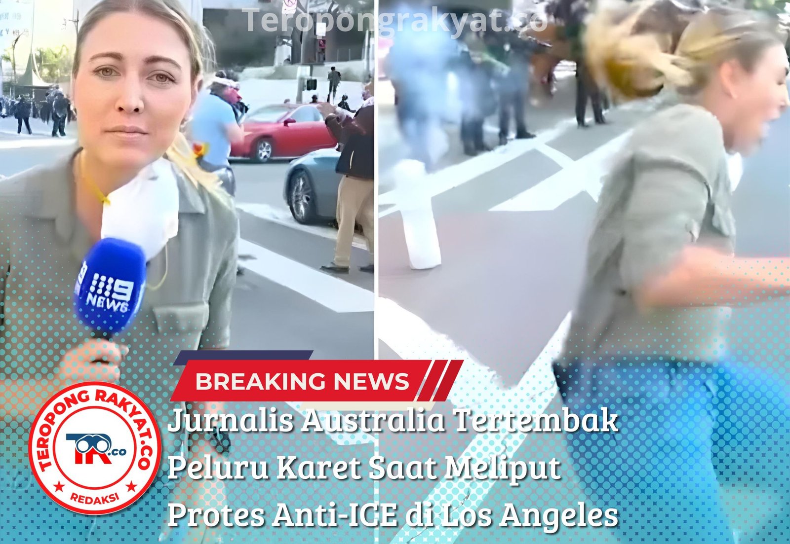 Jurnalis Australia Tertembak Peluru Karet Saat Meliput Protes Anti-ICE di Los Angeles