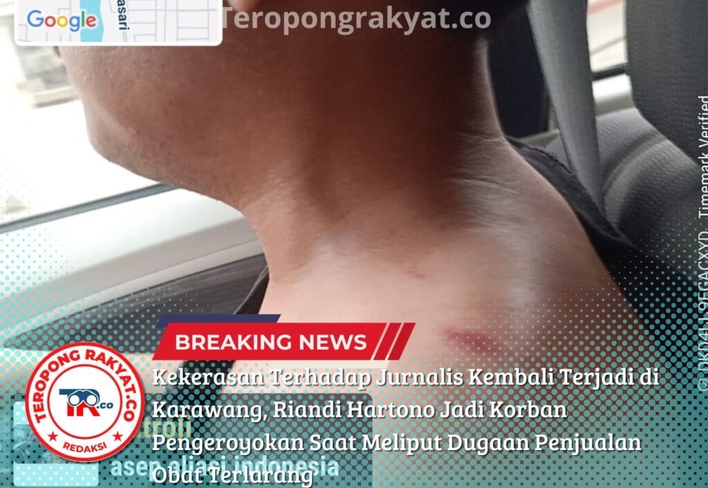 Portal Berita Indonesia dan Dunia Terkini Hari Ini, Update Harian Terbaru, Terlengkap, Tajam, Aktual dan Berimbang. Kekerasan Terhadap Jurnalis Kembali Terjadi di Karawang, Riandi Hartono Jadi Korban Pengeroyokan Saat Meliput Dugaan Penjualan Obat Terlarang - Teropong Rakyat