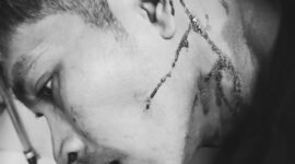 Korban Penganiayaaan Bernama Jay (34)