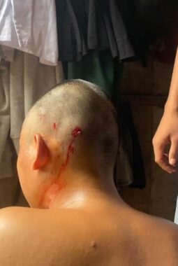 Polisi Lanjut Proses Dugaan Penganiayaan Santri Oleh Oknum Pengurus Ponpes Di Pasuruan