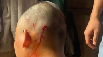 Polisi Lanjut Proses Dugaan Penganiayaan Santri Oleh Oknum Pengurus Ponpes Di Pasuruan