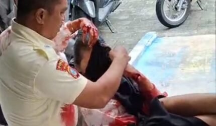 Mahasiswi Luka Bacok di Ruang Sidang UIN Suska Riau, Pelaku Ditahan Polisi - Teropong Rakyat
