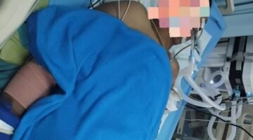 Keluarga Korban Pertanyakan Perkembangan Kasus, Polisi Sebut Pelaku Masih Dalam Pencarian