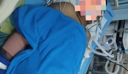 Keluarga Korban Pertanyakan Perkembangan Kasus, Polisi Sebut Pelaku Masih Dalam Pencarian - Teropong Rakyat
