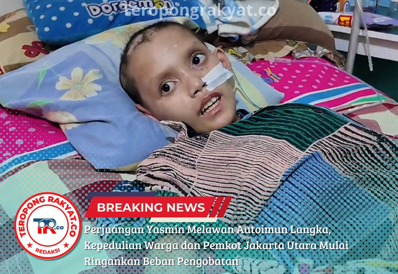Perjuangan Yasmin Melawan Autoimun Langka, Kepedulian Warga dan Pemkot Jakarta Utara Mulai Ringankan Beban Pengobatan